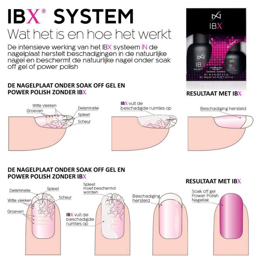 IBX – Origi-Nails